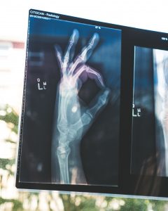 Photo X-Ray: (c) Owen Beard on Unsplash